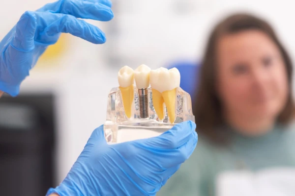 Illustration showing how a dental implant replaces the root of a missing tooth and supports a natural-looking crown