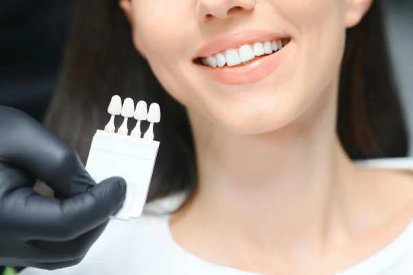 Porcelain veneers consultation with patient